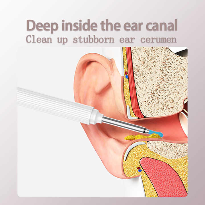 *Donut Offer* Smart Visual Ear Cleaner Camera – Ear Wax Removal Device