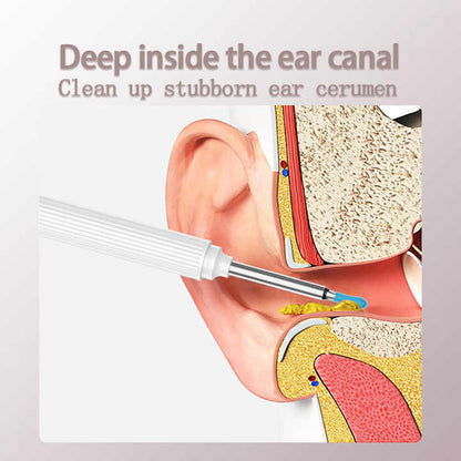 *Donut Offer* Smart Visual Ear Cleaner Camera – Ear Wax Removal Device