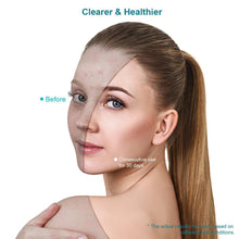 Load image into Gallery viewer, Xpreen - Light Therapy Face Mask for Acne Treatment and Firming Skin (Delivery in 28 days)